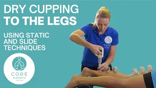 Demonstration of Dry Cupping to the legs using static and slide techniques