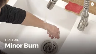 Learn first aid gestures: Minor Burn