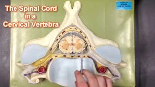 Spinal Cord Transection in Cervical Vertebra