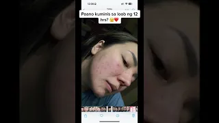 Grabe ka ROSMAR KOJIC PEELING SOAP at ROSMAR ICE SLEEPING MASK ❤️#rosmar #PINAKAMALAKAS #viral