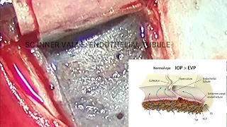 Schlemm´s canal anatomy.