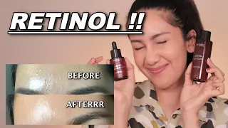 Akhirnya Bisa Pake RETINOL !!!! | suhaysalim