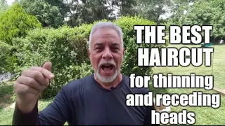 Best Haircut For Thinning And Receding Hair