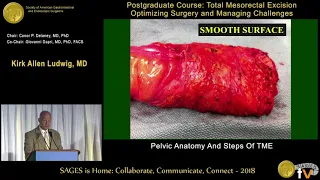 Pelvic anatomy & steps of TME