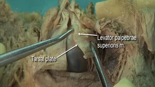 1.10 Step 2. Tarsal plates and conjunctiva