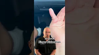 Does “Pull The Finger” Work for Finger Dislocation⁉️ #shorts