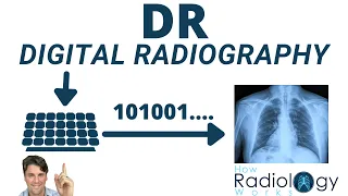 Direct vs Indirect Digital Radiography DR (for Radiologic Technologists)