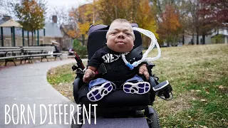 I'm The Oldest Person In The World With My Condition | BORN DIFFERENT