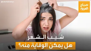 أسباب وراء شيب الشعر في سن مبكرة.. وما هي طرق العلاج؟