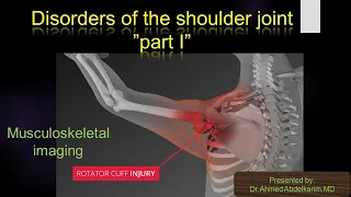 1-Disorders of the shoulder joint "part 1"