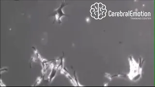 Sinapsis Neuronal