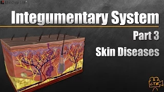 Integumentary System Part 3 of 3    Diseases of the Skin