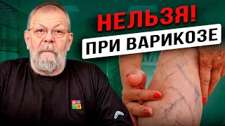 Что нельзя делать при варикозе? Доктор медицинских наук.