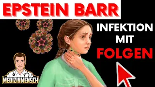 Epstein Barr Virus: Die Immunologischen Folgen EBV Infektion (wissenschaftlich erklärt)