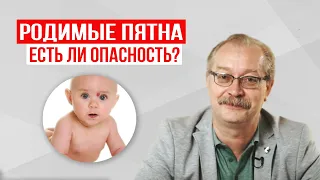 Как относиться к РОДИМЫМ ПЯТНАМ у детей? Советы доктора