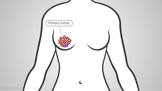 Vuja De Sciences Dormant Cancer Cells