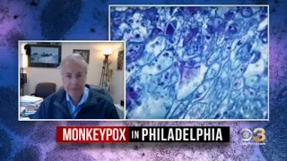 Jefferson Health's Dr. Rob Danoff Talks Monkeypox