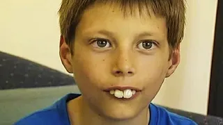 В 12 лет его называли мальчиком с самыми большими зубами. Как сложилась его судьба