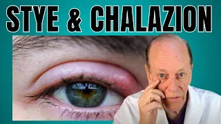 How a Plastic Surgeon Treats a Stye & Chalazion