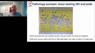 Clinical Laboratory Experience with TaqPath COVID-19 Testing