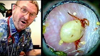 WE FOUND A TICK IN HIS EAR! (it was moving around)  | Dr. Paul