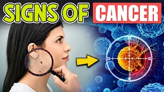 10 Early Warning Signs of CANCER Most People Dismiss Too Easily