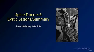 Spine tumors 6 – Cysts and Summary