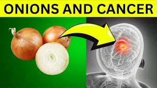 Never Eat Onion with This - Causes Cancer and Dementia - 3 Best & Worst Food Recipe Dr  John