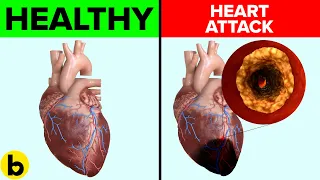 Knowing These 3 Types Of Heart Problems Will Save Your Life