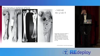 A Few Observations on the Marvelous Resilience of Bone & Resilience Engineering - Dr. Richard Cook