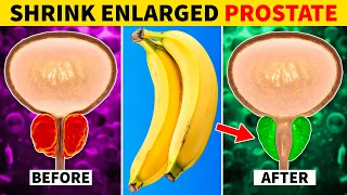 Top 8 Fruits to Shrink an Enlarged Prostate