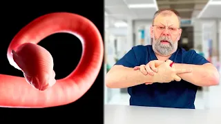 💊 Back Pain: Are Parasites to Blame? Unveiling Secrets with a Professor of Medicine! 🏥