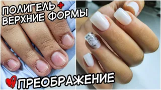 ПРЕОБРАЖЕНИЕ. НАРАЩИВАНИЕ ПОЛИГЕЛЬ НА ВЕРХНИЕ ФОРМЫ. РВАНАЯ КУТИКУЛА.