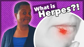 What is Herpes?