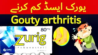 zurig 40 mg | zurig 80 mg tablet uses | zurig tablet uses in urdu | uric acid treatment | zurig 40mg