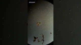 Cell Explodes Under Microscope (Hydrogen Peroxide vs Germs)