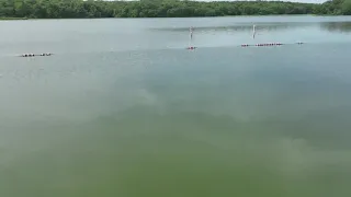 Man dies from brain-eating amoeba after swimming in lake
