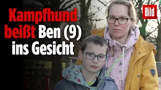 9-Jähriger von Kampfhund verletzt – die Hundebesitzerin flieht!