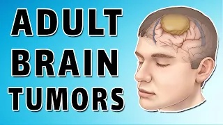 Adult brain cancers