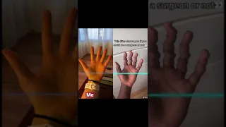 Real doctor tries viral TikTok surgeon challenge