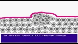 How Cancer Develops & Mutation