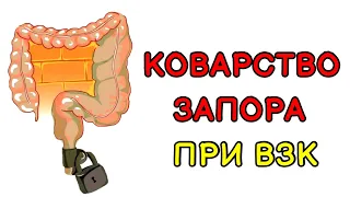 ВСЁ ПРО ЗАПОРЫ при Язвенном колите у Взрослых и Детей