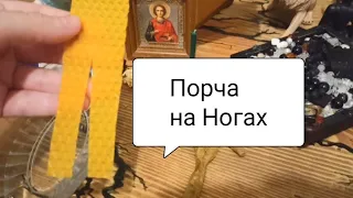 Порча на ногах. Боли и хруст в суставах, в венах, хромота.