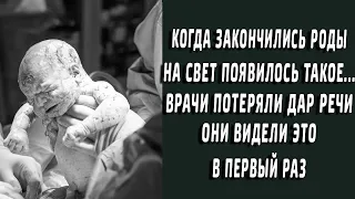 Когда закончились роды, на свет появилось такое… Врачи в шоке, они видели это в первые