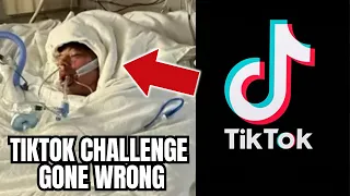TikTok Challenge Leaves Teen Disfigured with Nearly 80% of Body Burned | Reaction Video!