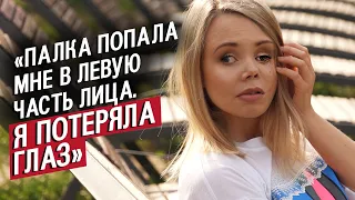 После ДТП мне заново собрали лицо: Оксана | Быть молодым