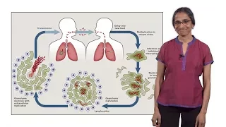 Lalita Ramakrishnan (Cambridge) 1: Tuberculosis: The Pathogenic Personality of the Tubercle bacillus