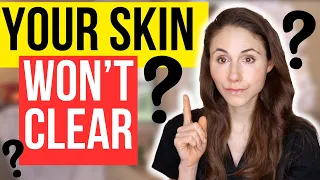 7 Reasons Why Your Skin Won't Clear