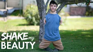 Man With No Arms Or Knees Becomes Internet Sensation | SHAKE MY BEAUTY