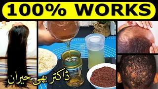 دنوں میں بال لمبے موٹے سلکی، خشکی ختم، نہ بال جھڑ، نہ گنجہ پن ! ڈاکٹر بھی حیران❗Fastest Hair Growth